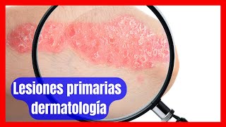 Claves para el Diagnóstico Dermatológico Descripción y Clasificación de Lesiones Primarias [upl. by Lorens]