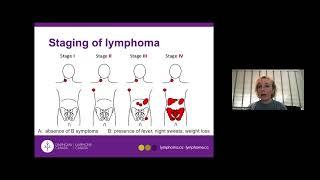 Day 2  Lymphoma Subtypes and Therapies  4 [upl. by Renrew]