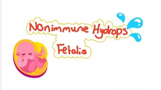 Nonimmune hydrops fetalis [upl. by Nyrb]