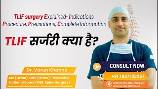 What is spinal fusion TLIF surgery क्या होता है स्पाइन फ्यूजन  spine backpain tlifsurgery [upl. by Krum]