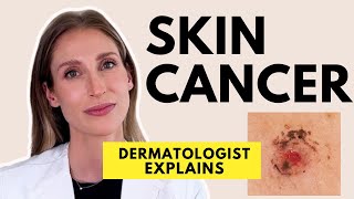 Skin Cancer Different Types Causes Prevention amp Treatments  Dr Sam Ellis [upl. by Akimert]