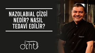 Nazolabial Çizgi Nedir Nasıl Tedavi Edilir [upl. by Rellim666]