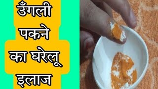 उँगली में पस सूजन दर्द का सबसे सटीक घरेलू उपचार peronychia homemade remedies rudrashaktikitchen [upl. by Dorehs179]