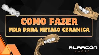 COMO FAZER FIXA PARA METALO CERAMICA exocad fluxodigital cad [upl. by Kalbli275]