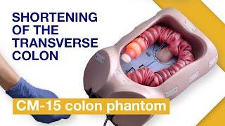 Basic Techniques of Colonoscope Insertion  Exercise 4 Shortening of the transverse colon [upl. by Yelrehs631]