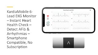 KardiaMobile 6Lead EKG Monitor – Instant Heart Health Check – Detect AFib amp Arrhythmias [upl. by Carrew]