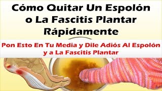 Pon Esto En Tu Media y Dile Adiós Al Espolon y a La Fascitis Plantar Como Quitar Un Espolon Rapido [upl. by Eiramac]