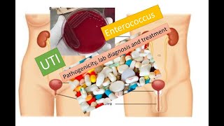 Enterococus pathogenecity lab diagnosis and treatment [upl. by Hsekar]