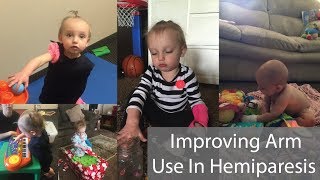 Improving Arm Use In Hemiparesis [upl. by Ylliw942]