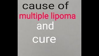 Cause of multiple LIPOMA tumor and its cure lymph system [upl. by Destinee]