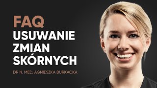 Jaki zabieg będzie najlepszy pod oczy Usuwanie cieni i worków pod oczami Cieślikowska Poznań [upl. by Ainoz]