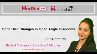 NEET PGOptic Disc Changes in Open Angle GlaucomaOphthalmology [upl. by Anaek]