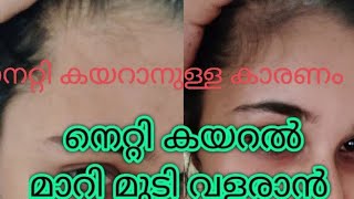 Netti kayaral why hair loss in forehead treatment and resons and its solution in home remedies [upl. by Oivat]