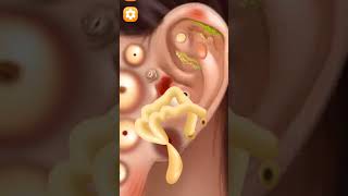 ASMR Ear Cleaning amp Treatments  Soothing Sounds for Relaxation 👂asmr animation cleaning ear [upl. by Lynad315]