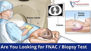 Biopsy FNAC Test in Hyderabad  Liver Lymph Node Thyroid Kidney Bone FNAC Biopsy  Official [upl. by Castorina377]