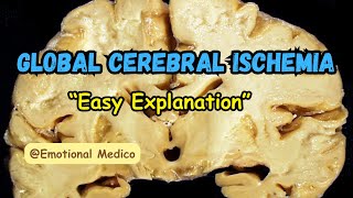 Global cerebral ischemia  Ischemia and infarction  CNS pathology  emotionalmedico [upl. by Innig]