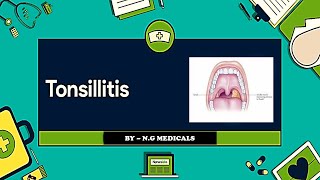 Tonsillitis  tonsil ke lakshan  टॉन्सिल को जड़ से खत्म करने का उपाय NGMedicals [upl. by Oswell]