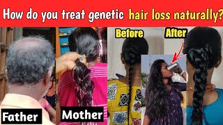 thin to thick hair genetic hair loss treatment at homecan genetic hair loss be cured [upl. by Tamqrah]