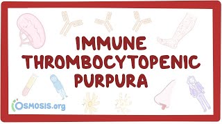 Immune thrombocytopenic purpura  an Osmosis Preview [upl. by Saire632]