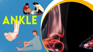 quotAnkle Sprains Explained Symptoms Prevention Treatment amp Global Impactquot [upl. by Niven]