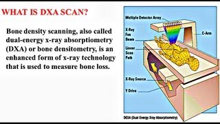 Bone Densitometry  Medical PowerPoint Presentation [upl. by Eisseb]