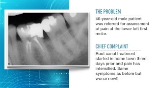 Advances in Endodontic Treatment Part 1Diagnosis and Treatment Planning [upl. by Angelique]