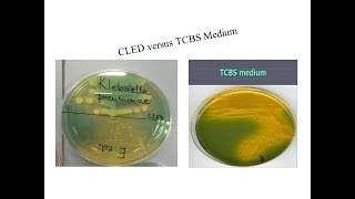 various bacterial growth in CLED and TCBS [upl. by Aimit]