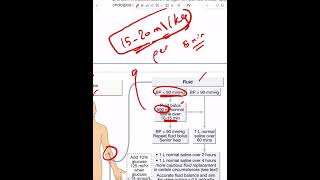 Diabetic Ketoacidosis  Part 3 [upl. by Dorcea]