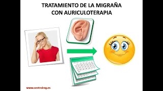 61 Tratamiento de la migraña con auriculoterapia Centro IMG [upl. by Ayom]