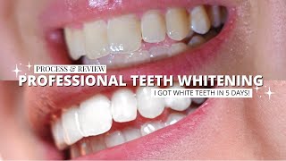 PROFESSIONAL TEETH WHITENING  360 Whitening Home Day Kit  Process amp Review [upl. by Daus873]