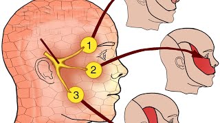 NEURALGIA DEL TRIGÉMINO Tratamientos varios [upl. by Steffi]