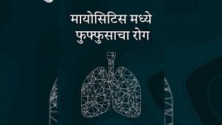 मायोसिटीस मध्ये फुफ्फुसचा रोग Pulmonary disease in myosistis [upl. by Bernadina]