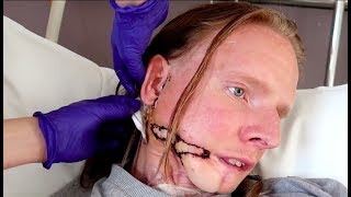 UNDERGOING 7 HOUR FACIAL SURGERY  Building A New Life Ep31 [upl. by Livingstone]