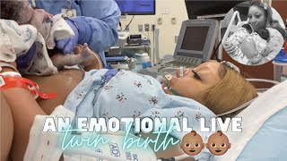 THE LIVE BIRTH OF OUR SECOND SET OF TWINS  Real Raw amp Emotional Doctor Turns Breech Baby in Womb [upl. by Kano404]