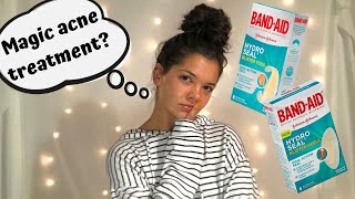 Do HydroSeal Bandages Really Help With Acne [upl. by Kiernan996]