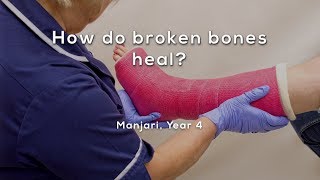 How do broken bones heal [upl. by Ecnerwal]