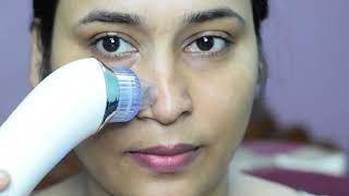 1 min blackheads amp whiteheads remove method OMG IT WORKED suction blackhead remover Review amp Demo [upl. by Jeffrey]