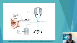 Labo 13 Irrigation vésicale [upl. by Ardnajela14]