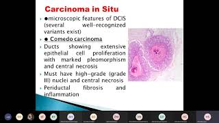 morphological types of breast cancer [upl. by Eatnahc]