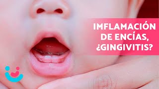 ENCÍAS INFLAMADAS en BEBÉS 😷👶🏻 ¡CUIDADO ¿Cómo Tratar la Gingivitis en Niños [upl. by Yniar]