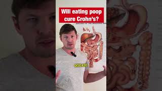 Eating POOP Magic Cure For Crohns Disease [upl. by Tonjes]