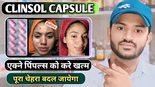 Clinsol capsule uses in hindi how to take clinsol capsule full review in hindi [upl. by Froehlich]