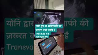 Transvaginal sonography [upl. by Amoihc]