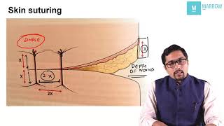 Suturing Techniques  Important topic for NEET PG  AIIMS  JIPMER  PGI exam [upl. by Benildis]