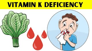 The Surprising Truth About Vitamin K Nobody Tells You [upl. by Buyse]