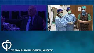 Live Case PFO Closure – transmission from Rajavithi Hospital [upl. by Chafee]