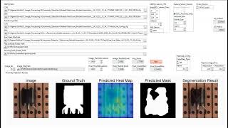 Visual Anomaly Defect Detection in LabVIEW [upl. by Ylirama38]