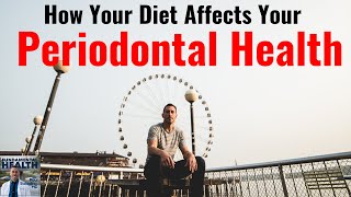 How Your Diet Affects Your Periodontal Health w Al Danenberg [upl. by Queenie]