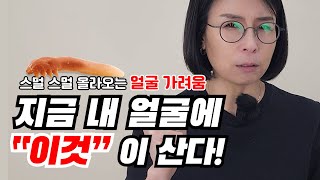 얼굴은 깨끗한데 스멀 스멀 올라오는 얼굴가려움 내 얼굴에 무언가 살고있다🤔 [upl. by Jany]