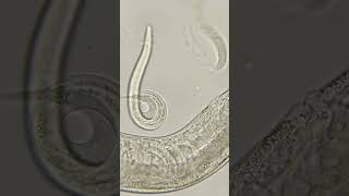 Phylum Aschelminthes Nematoda Roundworms [upl. by Arihsa510]